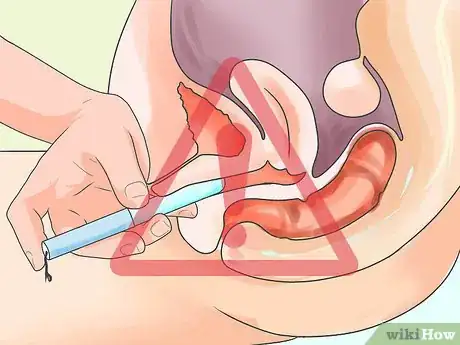 Imagen titulada Know if You Have Toxic Shock Syndrome Step 7