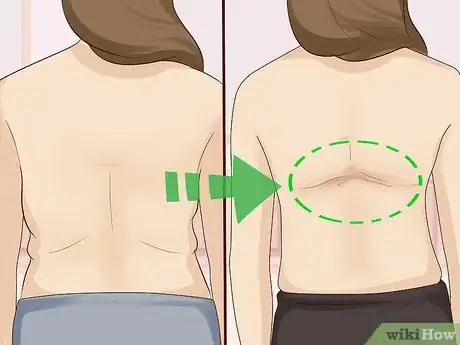 Imagen titulada Get Rid of Bra Bulge or Bra Fat Step 11.jpeg