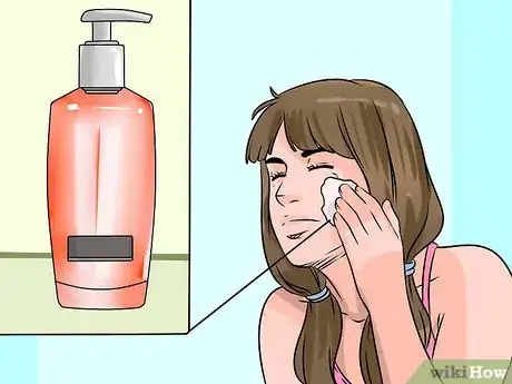 Imagen titulada Get Rid of Acne Naturally Step 1
