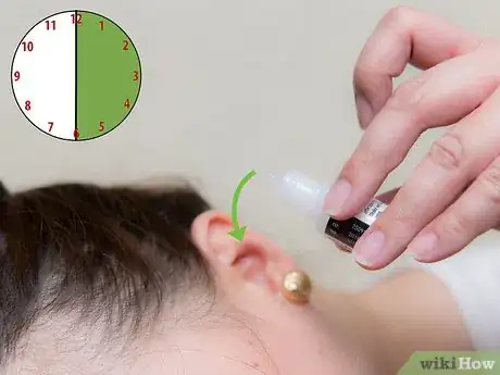 Imagen titulada Clear up Ear Congestion With Olive Oil Step 6