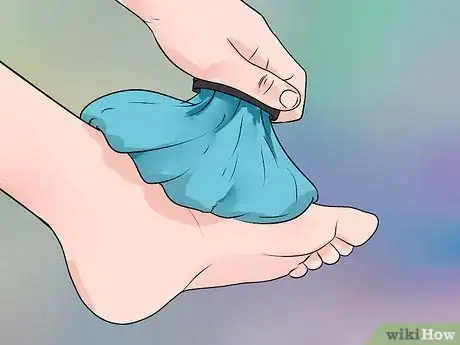 Imagen titulada Reduce Swelling in Feet Step 19