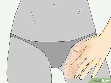 Imagen titulada Prepare for a Bikini Waxing Step 3