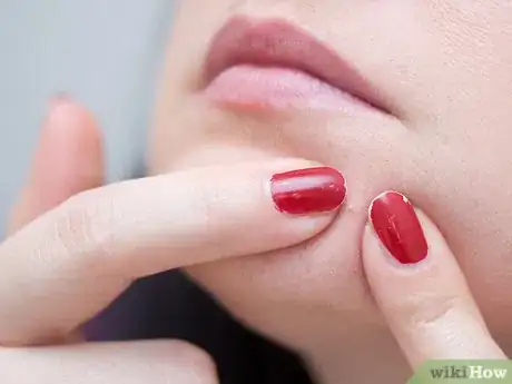 Imagen titulada Create a Hot Compress for Acne Treatment and Skin Health Step 11