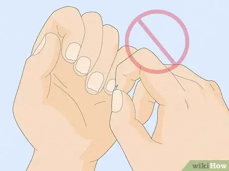 Imagen titulada Get Rid of White Spots on Your Nails Step 9