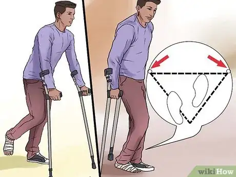 Imagen titulada Walk on Crutches Step 10