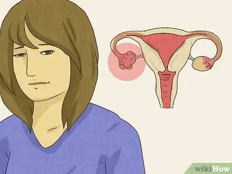 Imagen titulada Know if You Are Infertile Step 8