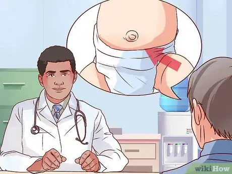 Imagen titulada Diagnose a Child's Hernia Step 2