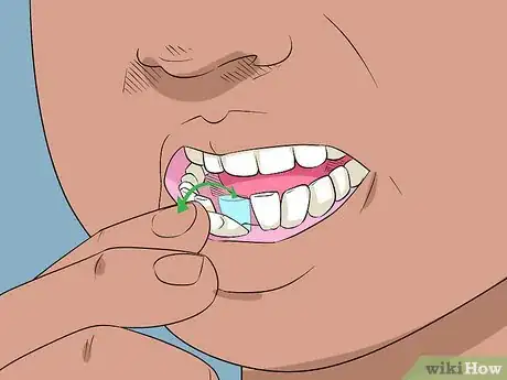 Imagen titulada Pull out a Loose Tooth Step 1