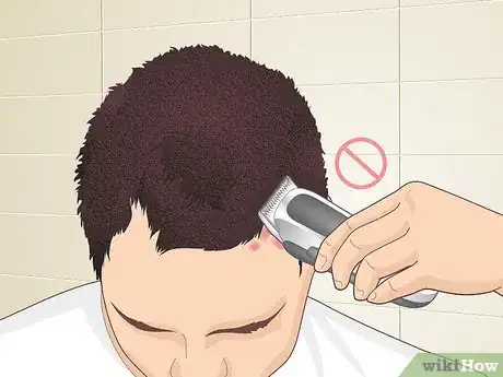 Imagen titulada Bumps on Scalp Step 10