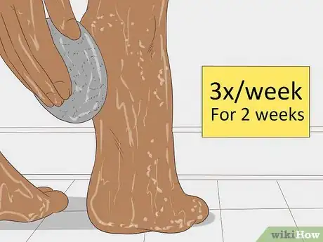 Imagen titulada Remove Dry Skin from Your Feet Using Epsom Salt Step 19