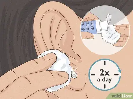 Imagen titulada Clean a New Ear Piercing Step 11