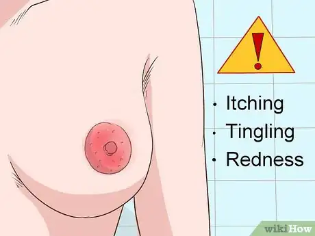 Imagen titulada Treat Breast and Extramammary Paget's Disease Step 10