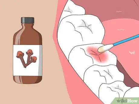 Imagen titulada Cure a Toothache Step 10