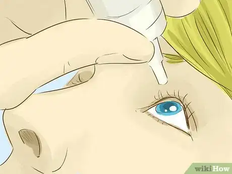 Imagen titulada Remove Something from Your Eye Step 4