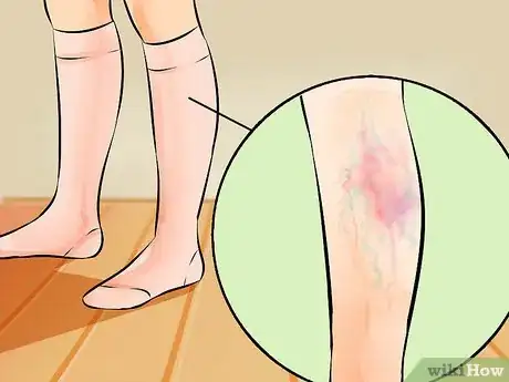 Imagen titulada Put on Compression Stockings Step 21