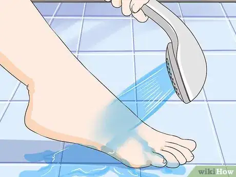 Imagen titulada Remove Stains from Your Feet Step 10