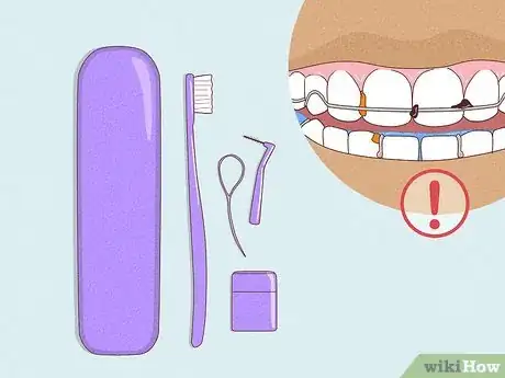 Imagen titulada Cope with Twin Block Braces Step 5