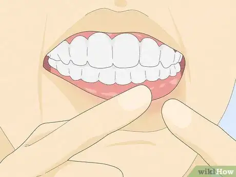 Imagen titulada Fix a Loose Tooth Step 5