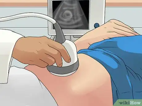 Imagen titulada Know if You Have an Ovarian Cyst Step 8