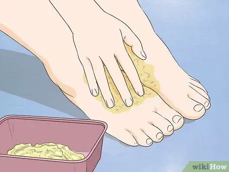 Imagen titulada Remove Stains from Your Feet Step 11