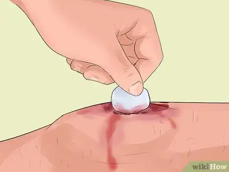 Imagen titulada Treat Severe Bleeding During First Aid Step 4