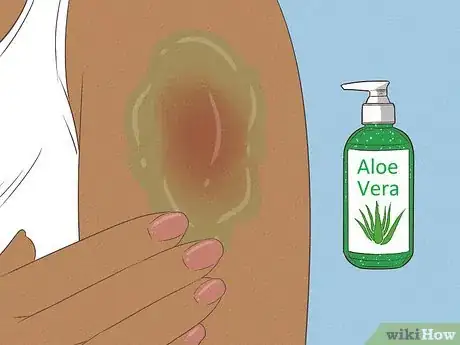 Imagen titulada Cope with Itchy Skin During Menopause Step 14