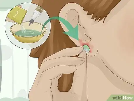 Imagen titulada Clean an Infected Ear Piercing Step 3