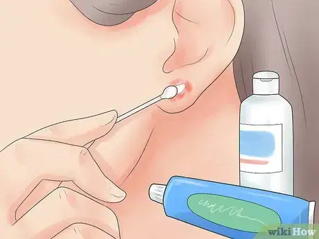 Imagen titulada Take Care of Infection in Newly Pierced Ears Step 3