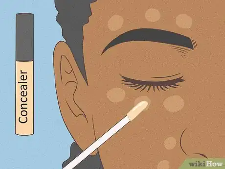 Imagen titulada Get Rid of Spots on Your Skin Step 10