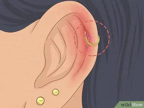 Imagen titulada Is It Safe to Pierce Your Own Cartilage Step 24