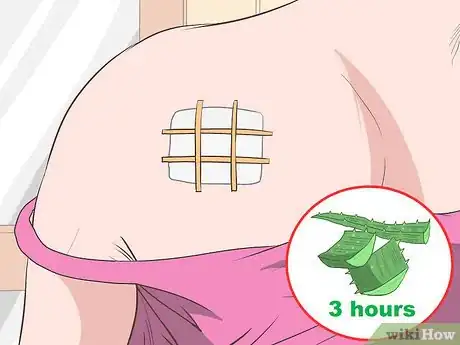 Imagen titulada Remove Moles Without Surgery Step 12