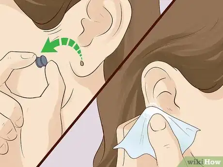 Imagen titulada Close Gauged Ears Step 4.jpeg