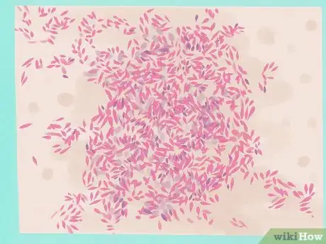 Imagen titulada Gram Stain Step 17