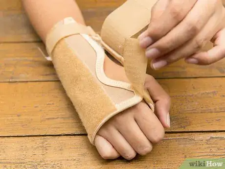 Imagen titulada Clean a Wrist Brace Step 12