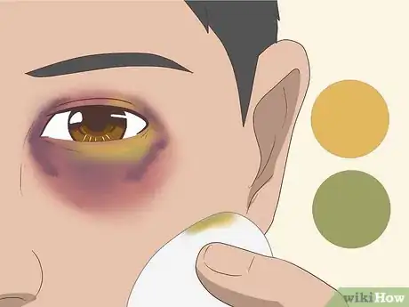 Imagen titulada Make a Fake Black Eye Step 11