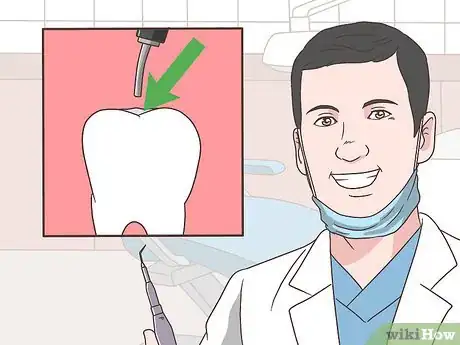 Imagen titulada Care for Your Teeth Step 13