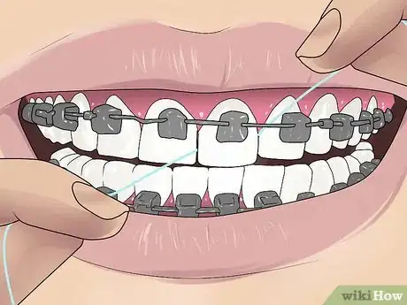 Imagen titulada Floss With Braces Step 6