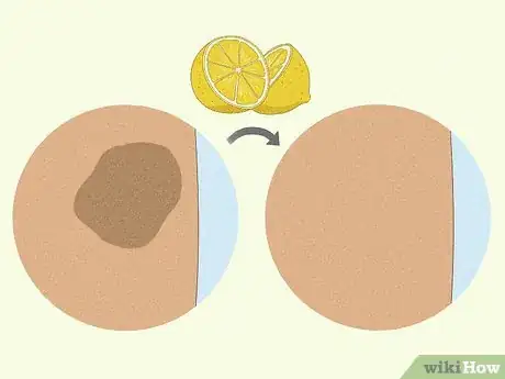 Imagen titulada Use a Lemon to Lighten Your Skin Step 2