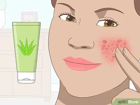 Imagen titulada Use Aloe Vera Gel on Your Face Step 8