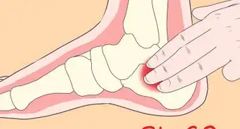 usar puntos de acupresión para el dolor en los pies