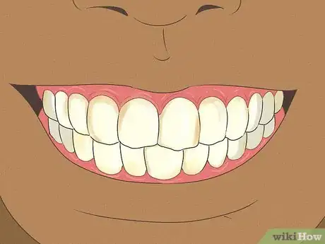 Imagen titulada Fix Nicotine Stained Teeth Step 11