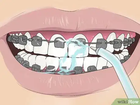 Imagen titulada Floss With Braces Step 12