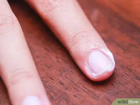 Imagen titulada Remove Nail Polish from Around the Nails Step 13