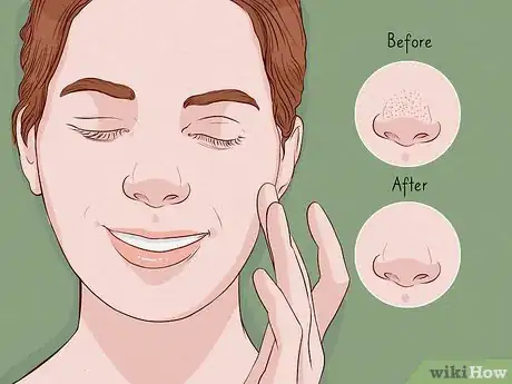 Imagen titulada Close Blackhead Holes Step 6