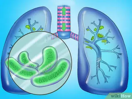 Imagen titulada Recognize the Signs and Symptoms of Tuberculosis Step 10