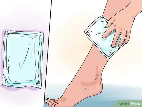 Imagen titulada Treat a Torn Calf Muscle Step 5