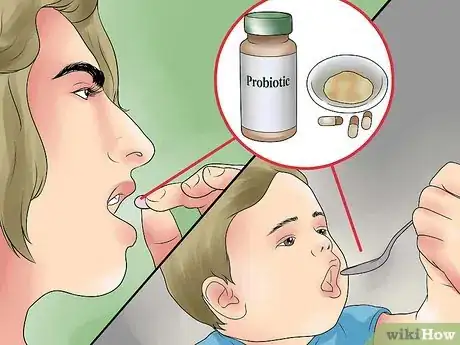 Imagen titulada Treat Oral Thrush Step 1