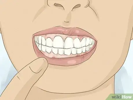 Imagen titulada Get Whiter Teeth at Home Step 17