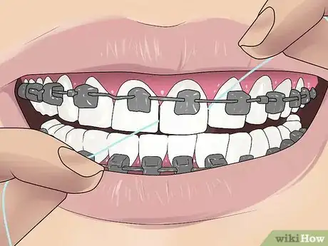 Imagen titulada Floss With Braces Step 9