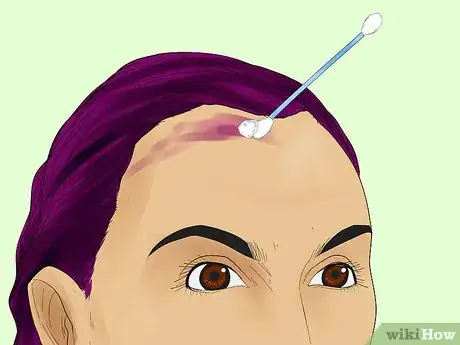 Imagen titulada Remove Hair Dye from Your Scalp Step 11